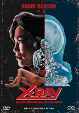 (X-Ray L.E.131 (Cover B)) `I love you!` Mit diesem zärtlichen Kartengruß beginnt am Valentinstag eine grauenvolle Jagd. Ein abgewiesener Liebender, wahnsinnig geworden und völlig unberechenbar, veranstaltet eine mörderische Hatz, die blutige Spuren durch endlose Korridore und die Operationssäle einer Klinik zieht. Verrückt vor Liebe zur schönen Susan vernichtet der sadistische Mörder Harry alles und Jeden, an dem die gejagte Frau hängt. unbarmherzig treibt er sie in eine Sackgasse des Irrsinns, an deren Ende der Tod lauert. Gibt es auch für Susan kein Entkommen... ? Artikelbild